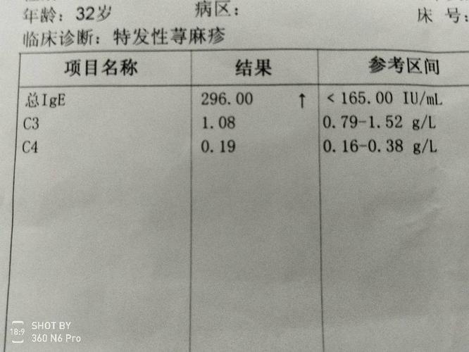 2014年得寻麻疹检查结果是狗毛过敏,已经很久没有复发了,还可以养狗嘛？（寻麻疹养狗）