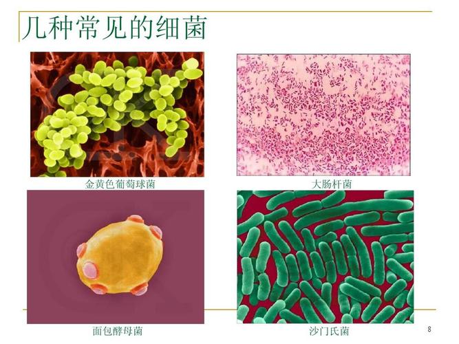 沙门氏菌英语缩写？（生猪葡萄球菌）